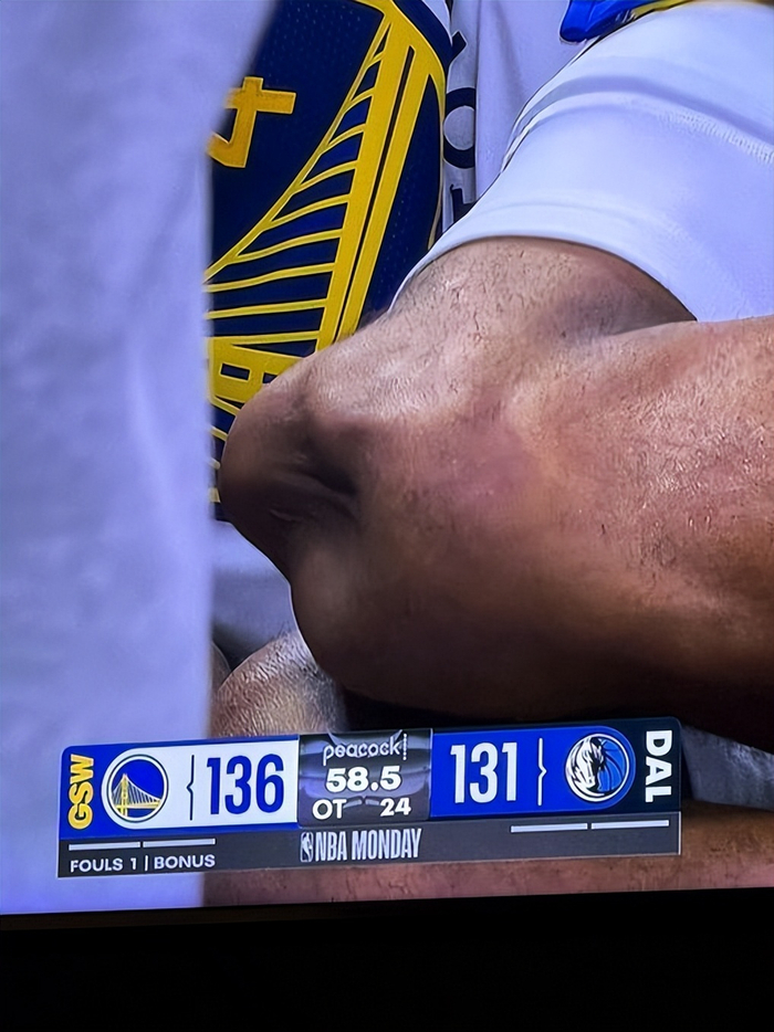 勇士格林细述穆迪伤情：髌骨肌腱重伤或致赛季